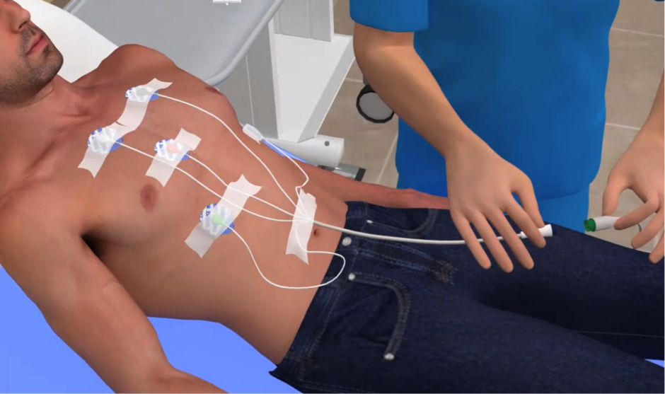 EKG or ECG procedure in 3-D animations